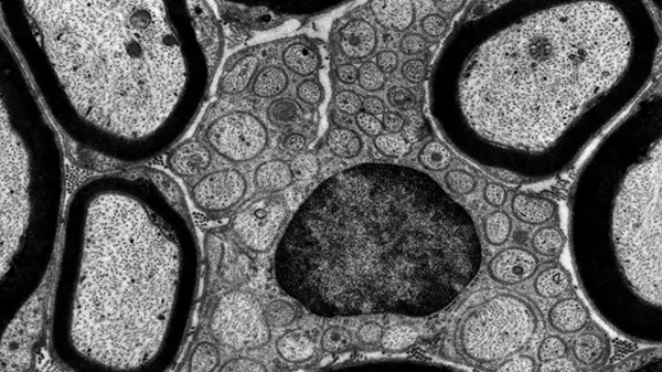 Hình ảnh kính hiển vi truyền TEM tạo ra